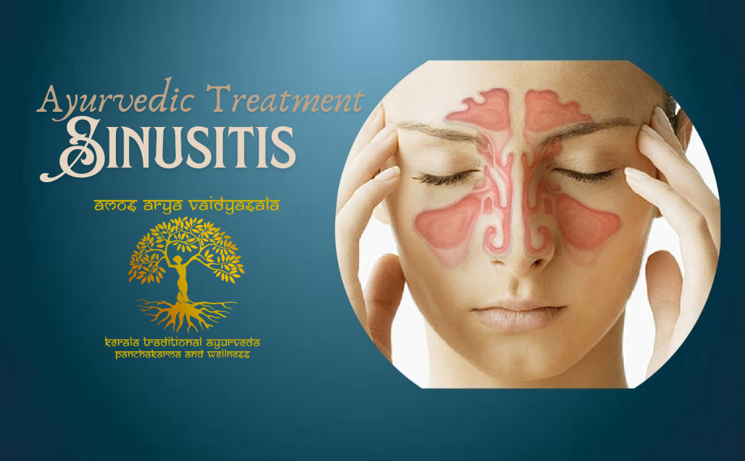 Treat Sinusitis through ayurveda 
